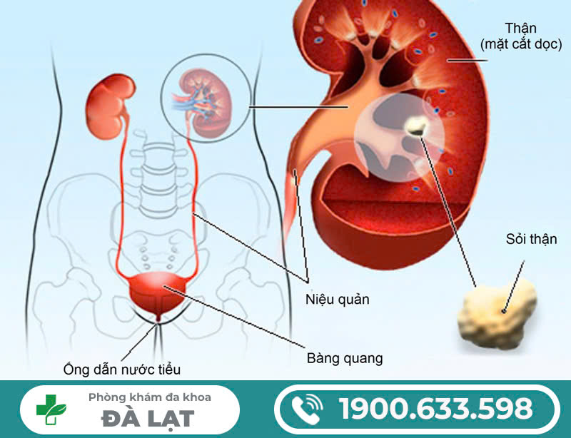 Hình ảnh minh họa